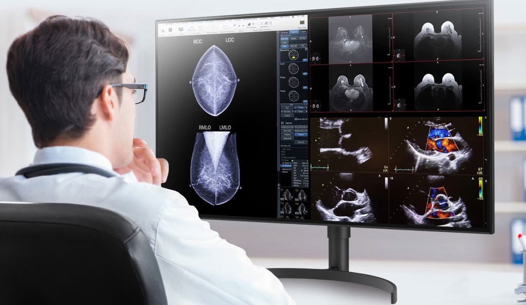 [32HL512-B] 32HL512-B LG 32" 32HL512D-B IPS Diagnostic, Multi-Input, PBP,  Height Adjust, Realistic Colour, Pathology Mode, Monitor. Project and Professional